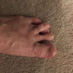 Willamette Foot Center - Left foot.
