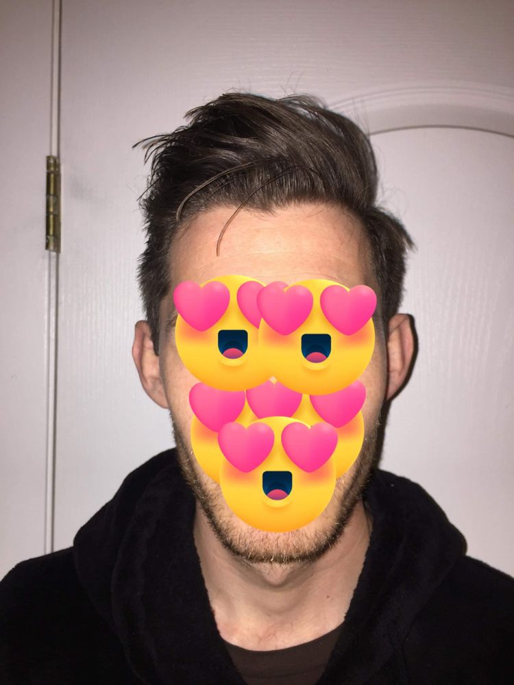 Hair Structure Image