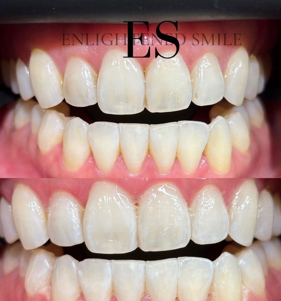 Enlightened Smile Logo