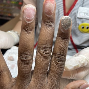 Davi Nails - Bleeding finger nail - Nail Salons Near Me - Salem, Oregon Davi Nails - Bleeding finger nail - Nail Salons Near Me - Salem, Oregon