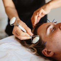 Yorkville Sports Medicine Clinic - Beauty Facial Acupuncture