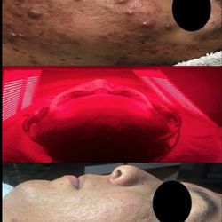 Before and After