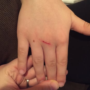 Plaza Azteca - Sicklerville - They dropped a glass and cut my 7 yr olds hand - NO comped food or anything!!! - Mexican Near Me - Sicklerville, New Jersey Plaza Azteca - Sicklerville - They dropped a glass and cut my 7 yr olds hand - NO comped food or anything!!! - Mexican Near Me - Sicklerville, New Jersey