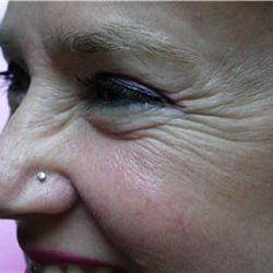 Bellissima Medical Aesthetics