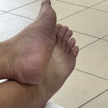Tiffany's Nail And Spa - This is a picture of AFTER his pedi was done. - Nail Salons Near Me - Gainesville, Florida Tiffany's Nail And Spa - This is a picture of AFTER his pedi was done. - Nail Salons Near Me - Gainesville, Florida