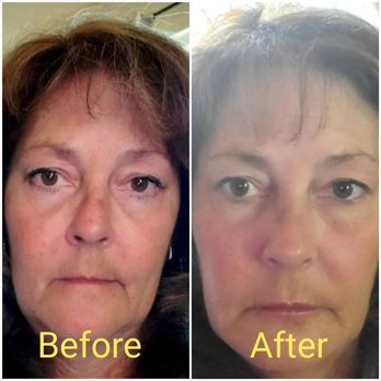 Dimensionz Injectables and Aesthetics - Medical Spas Near Me - Fort Collins, Colorado
