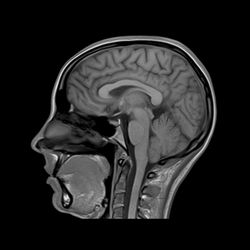 Noble MRI