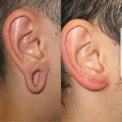 Dev Wali, MD Plastic Surgery-Medspa