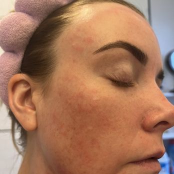 SILVER MIRROR FACIAL BAR - MANHATTAN WEST - Updated December 2025 - 21