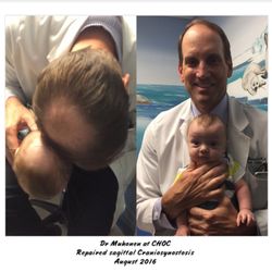 Muhonen Michael, MD - our 4th baby boy had surgery with Dr M and he wore a helmet afterwards and he is now almost 4 and is thriving!