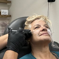 Revive IV Therapy & Med Spa - Starting the injections