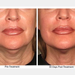 Westport Medispa - Dana Brownell, MD