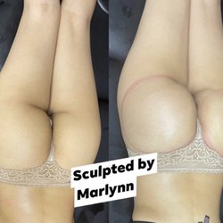 Hourglass Body and Beauty Bar - Brazilian Butt Lift
