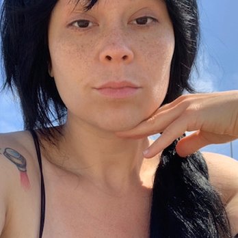 Botoxie - This where I started. This was taken shortly before my first lip filler about a year ago. - Medical Spas Near Me - San Diego, California
