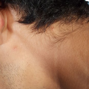 Best Western Clovis Cole - BED BUG BITES ON MY NECK, ARMS, LEGS, AND HANDS!!! - Hotels Near Me - Clovis, California