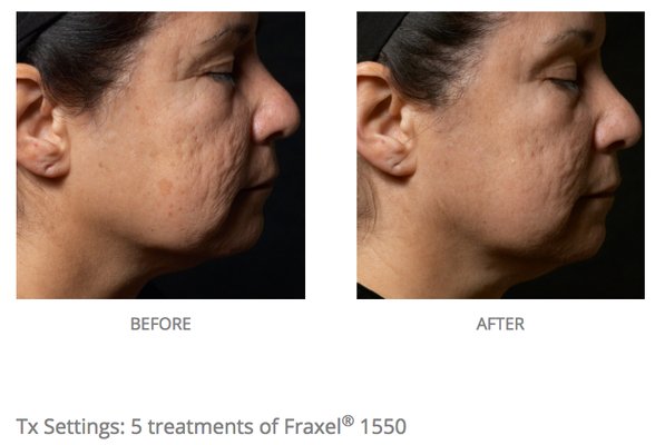 ASSOCIATED SKIN CARE SPECIALISTS, PA - 32 Photos - 18315 Cascade Dr