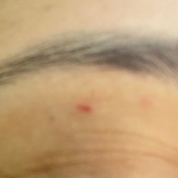 She teared off my skin these pictures don't even do justice :/