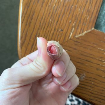 Smoke Plus - Cut open finger from unchecked broken glass - Tobacco Shops Near Me - Weatherford, Texas Smoke Plus - Cut open finger from unchecked broken glass - Tobacco Shops Near Me - Weatherford, Texas