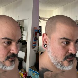 Headliner - David made this image from my original hairline to illustrate what the end result would look like.