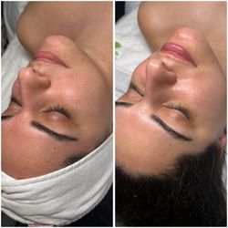 Vida Artistry Salon - Lets Glow Girl Facial - Our dermaplaning facial by Andreia