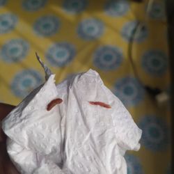 Baxter Pest Doctors - Tipo fezes