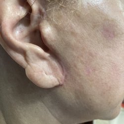 Phoenix Skin - Right ear