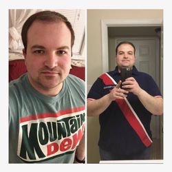Medi-Weightloss Woodbridge