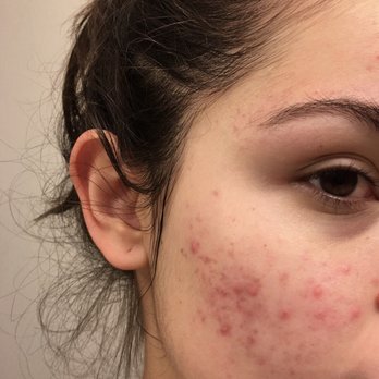 Juvena Skin Care - Skin Care Near Me - Las Vegas, Nevada Juvena Skin Care - Skin Care Near Me - Las Vegas, Nevada