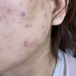 Peebro Skin & Total Health Care