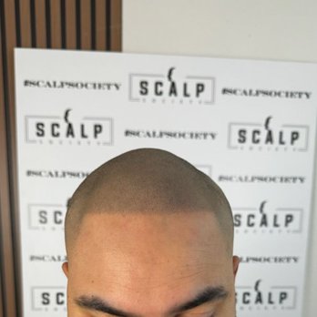 Scalp Society - Hair Loss Centers Near Me - San Jose, California