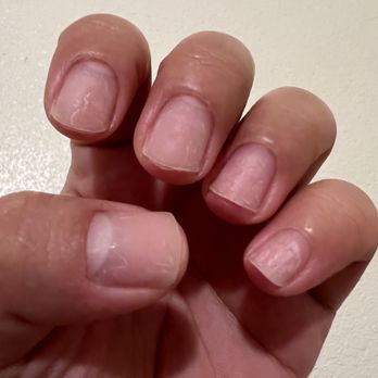 Fancy Nails Lounge - Damage to nails after gel polish removal - Nail Salons Near Me - Pinole, California Fancy Nails Lounge - Damage to nails after gel polish removal - Nail Salons Near Me - Pinole, California