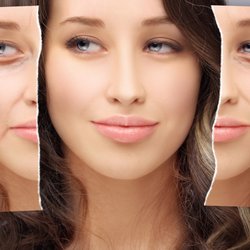 Kevin Ortale, DDS - We offer Juvederm for lip enhancements and unwanted creases in face.