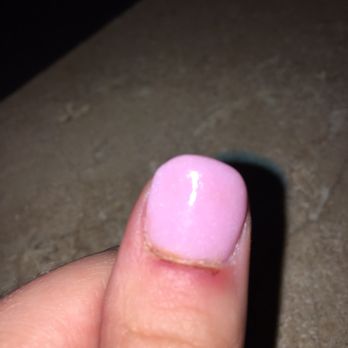 Pink Lady Nails Salon - My nail bed that was split open by a nail buffer. Two days later and it still bleeds but is very very sore to the touch and very red. - Day Spas Near Me - Queensbury, New York