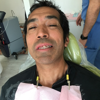 Dental Studio of Pasadena - My man before..... - General Dentistry Near Me - Pasadena, California