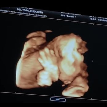 Before the Stork 4D - Ultrasound Imaging Centers Near Me - Anaheim, California
