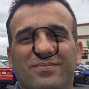 Alexis Furze, MD - Look how deviated it wss - Ear Nose & Throat Near Me - Newport Beach, California Alexis Furze, MD - Look how deviated it wss - Ear Nose & Throat Near Me - Newport Beach, California