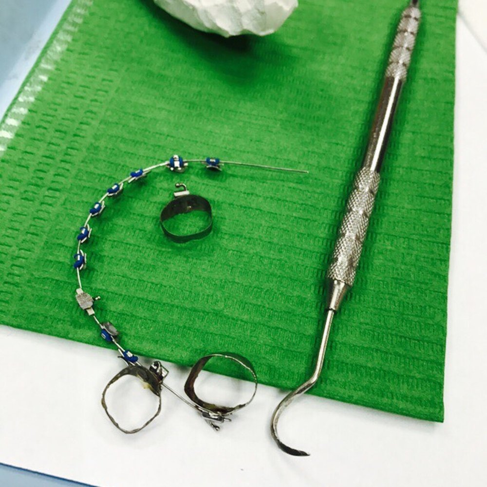 Dr. Raúl Montiel Morales - My old bracket, byeeeeeeee! - Orthodontists Near Me - Tijuana, BCN