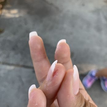 Nails Place - Really bad cut this hurts so much I was bleeding so much - Nail Salons Near Me - Santa Ana, California Nails Place - Really bad cut this hurts so much I was bleeding so much - Nail Salons Near Me - Santa Ana, California
