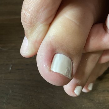 G Nails & Spa - I honestly didn't even care to go back in there to get polish fixed. But my toe is irritated (it wasn't before), red, and hurts to walk on. - Nail Salons Near Me - Bedford, Texas
