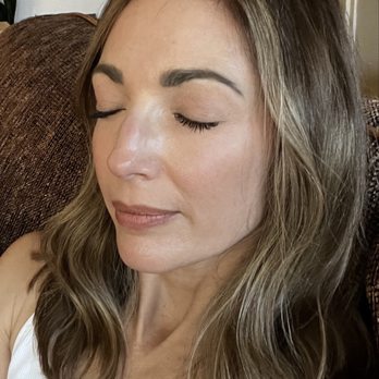 Aria Aesthetics - Post 3 microneedling sessions. Skin is glowing! - Medical Spas Near Me - Hollister, California Aria Aesthetics - Post 3 microneedling sessions. Skin is glowing! - Medical Spas Near Me - Hollister, California