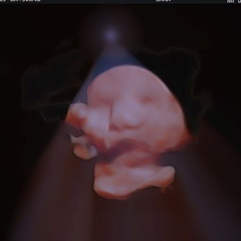 Unique Ultrasound - 4D Ultrasound - Diagnostic Imaging Near Me - Temecula, California Unique Ultrasound - 4D Ultrasound - Diagnostic Imaging Near Me - Temecula, California