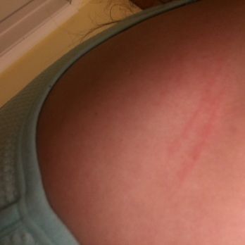 Massage Envy - Claw marks after. I can repost the updates when they turn into scabs... - Massage Near Me - Tampa, Florida Massage Envy - Claw marks after. I can repost the updates when they turn into scabs... - Massage Near Me - Tampa, Florida