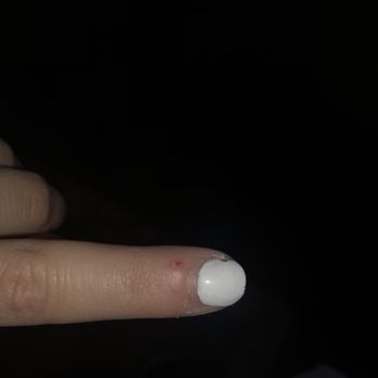 Ruby Nail - Got them done a week ago, chipped and the skin around my nails is very bad - Nail Salons Near Me - Glendale, California