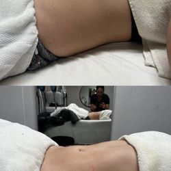 Slim Silhouette Body Sculpting - Tummy Detox & EMSlim