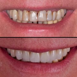 Smile Design Center of Westchester