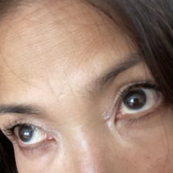BeautyFix - Freckles, freckles, everywhere; use a dab of cream.