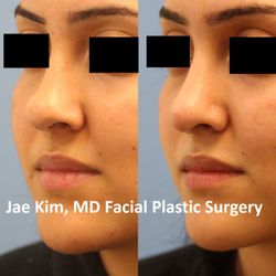 Jae Kim MD, Facial Plastic Surgery - Jae Kim, MD Facial Plastic Surgery