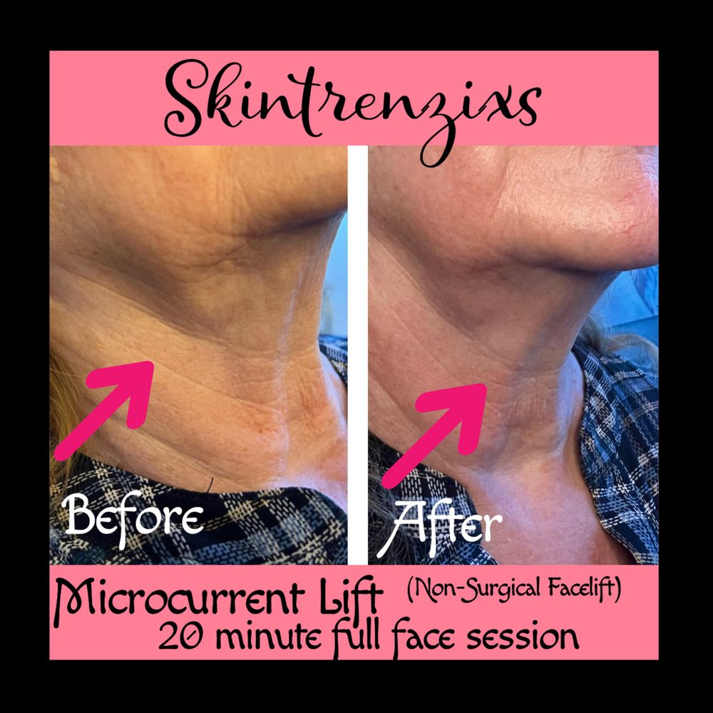 Melissa Cundiff Esthetics Birmingham - Skintrenzixs Logo