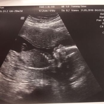 Tummy Time - Diagnostic Imaging Near Me - Salida, California Tummy Time - Diagnostic Imaging Near Me - Salida, California