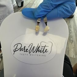Pure White Teeth Whitening